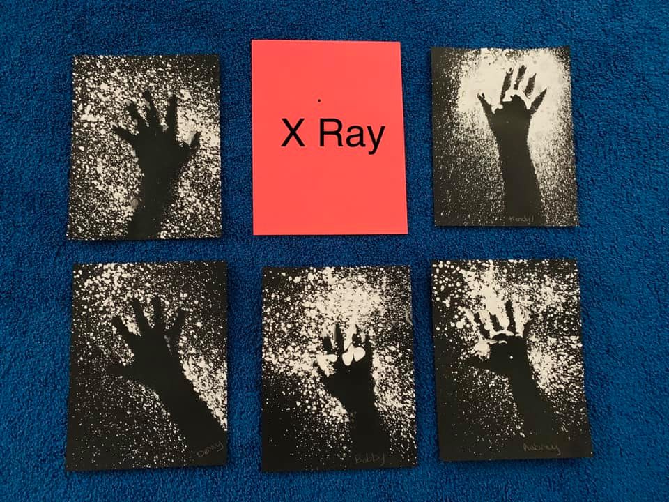 X-Ray Crafts for Preschoolers